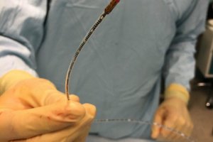 Взгляд изнутри: технология внутрипросветного УЗИ на&nbsp;службе сосудистой хирургии