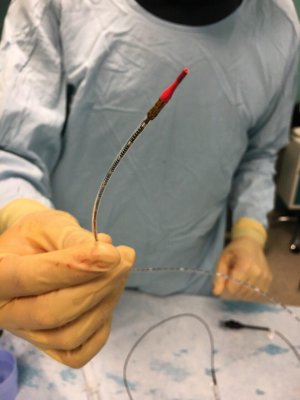 Взгляд изнутри: технология внутрипросветного УЗИ на службе сосудистой хирургии