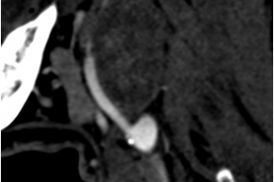 Уникальная операция