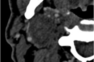 Уникальная операция