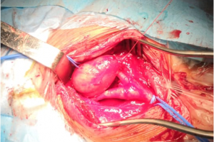 Уникальная операция