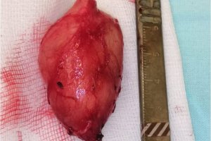 Уникальная операция