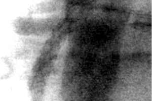 Уникальная операция