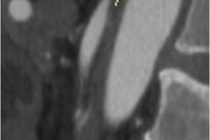 Уникальная операция