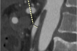 Уникальная операция