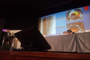 18-19 октября, VI Курс по лечению Критической ишемии конечности КИНК 2019, Москва