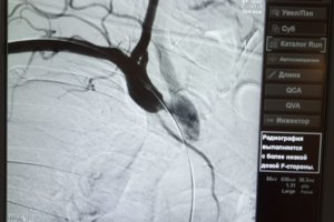 радиография