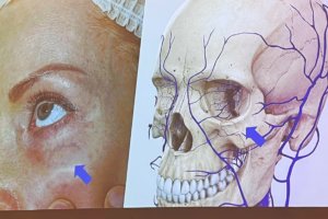 6-й Всероссийский съезд специалистов по эстетической флебологии c международным участием