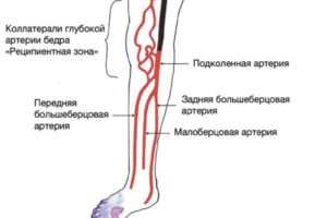 Новая публикация сосудистых хирургов Центра им. Т.Топпера в специальном выпуске журнала «Клиническая больница»